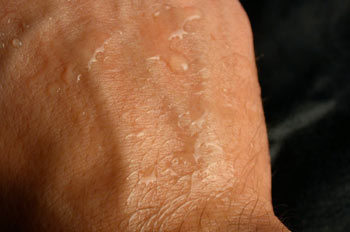 El sudor nos sirve para regular la temperatua corporal